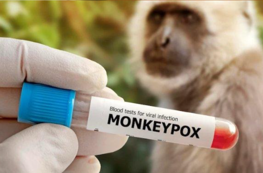  Mengenal Virus Monkeypox: Virus yang Sudah Ada Sejak 1958, Namun Belum Ditemukan Obatnya